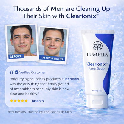 Lumelia Clearionix™ Acne Slayer